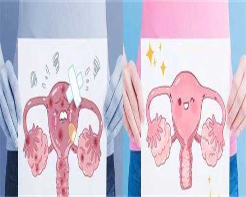 舟山单身女性必看：精子少不育？代孕供卵选性别全攻略