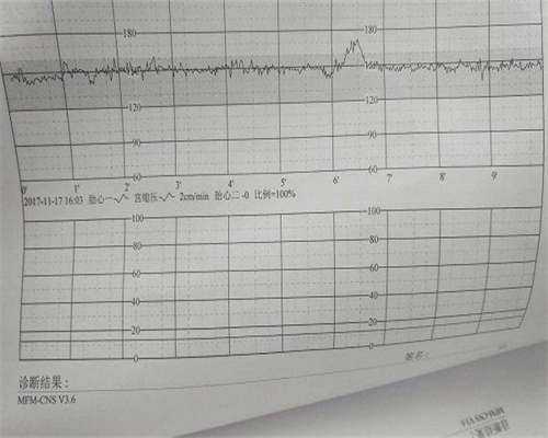 珠海高龄备孕必看：不孕不育全面检查与三代试管攻略