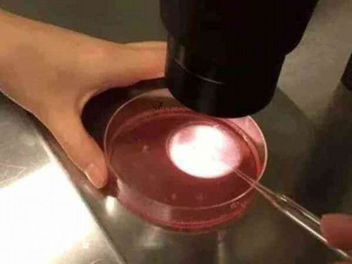 不孕不育检查流程