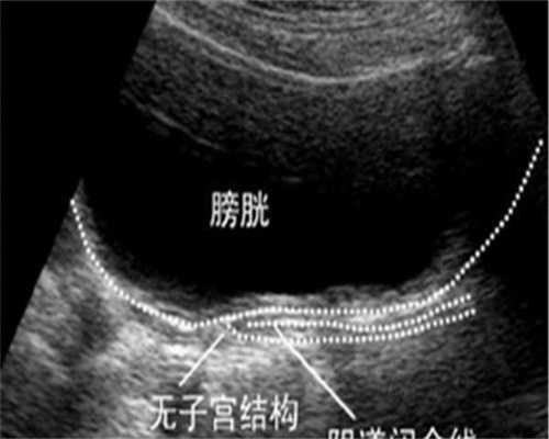 盐城高龄备孕生化妊娠试管，供卵三代试管助力好孕