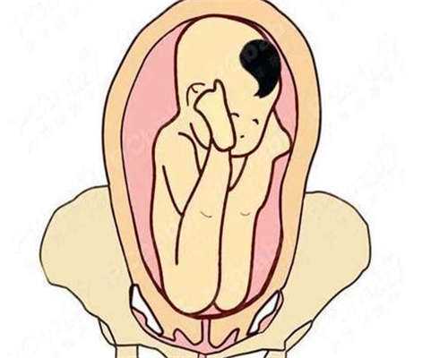 衢州高龄二胎不孕？选性别供卵三代试管代怀全解析