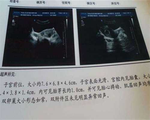 盐城高龄备孕：抗卵巢抗体不孕如何通过三代试管成功好孕？