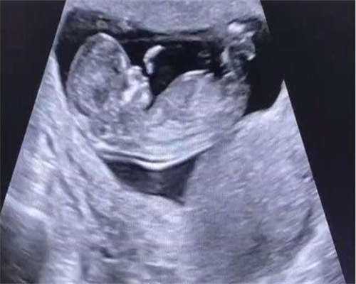 西安高龄备孕纵隔子宫试管攻略：代生代怀与三代试管详解
