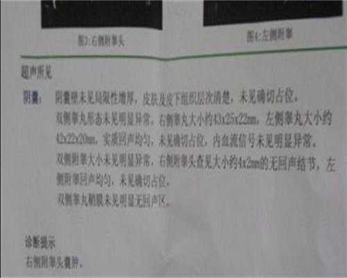 舟山单身女性抗精子抗体不孕，供卵三代试管助孕攻略