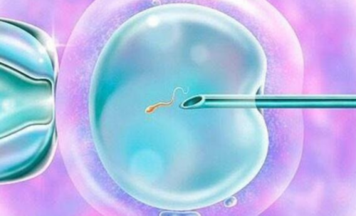 乌克兰女性不孕挂什么科？代怀供卵三代试管全攻略