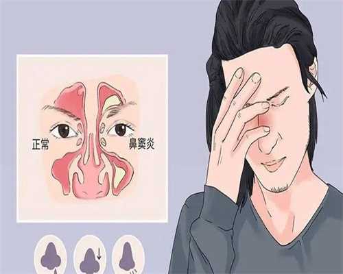 绍兴特殊需求人群克氏综合征不育全攻略：专业医生为您详细解读