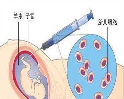 衢州高龄备孕怀不上？三代试管代生代怀选性别供卵全攻略
