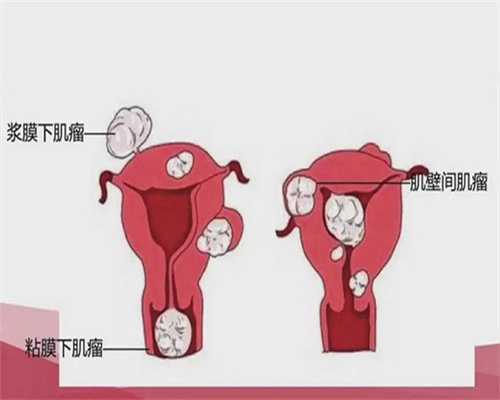 珠海精子DNA碎片率高导致不育？代生代怀选性别供卵三代试管全攻略