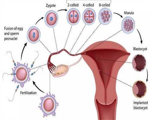 高龄女性供卵试管婴儿的可行性与情感接纳