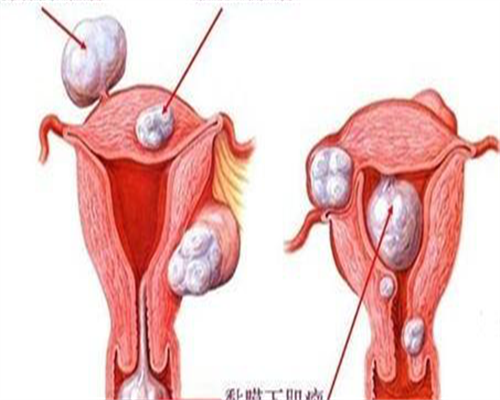 舟山单身女性必读:精子数量少不育,三代试管供卵代怀助你圆梦