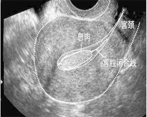<b>供卵试管婴儿成功率真相与术后注意事项</b>