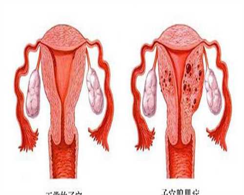 上海多囊卵巢促排指南:什么情况下可以安全进行?