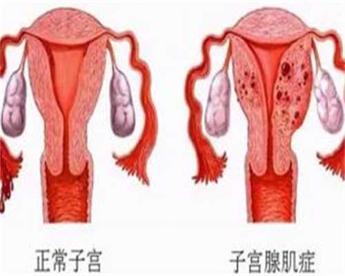 金华不孕不育在线咨询:三代试管与代怀选性别全攻略